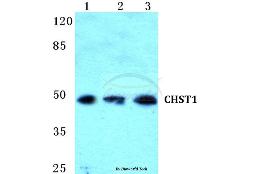 Anti-CHST1 Antibody from Bioworld Technology (BS5662) - Antibodies.com