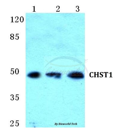 Anti-CHST1 Antibody from Bioworld Technology (BS5662) - Antibodies.com