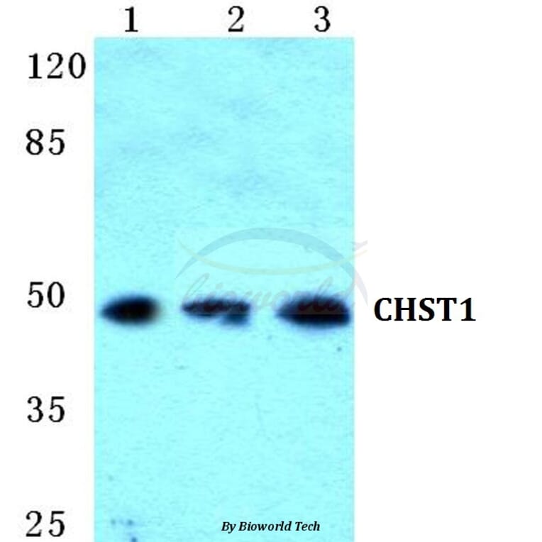 Anti-CHST1 Antibody from Bioworld Technology (BS5662) - Antibodies.com
