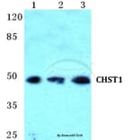 Anti-CHST1 Antibody from Bioworld Technology (BS5662) - Antibodies.com