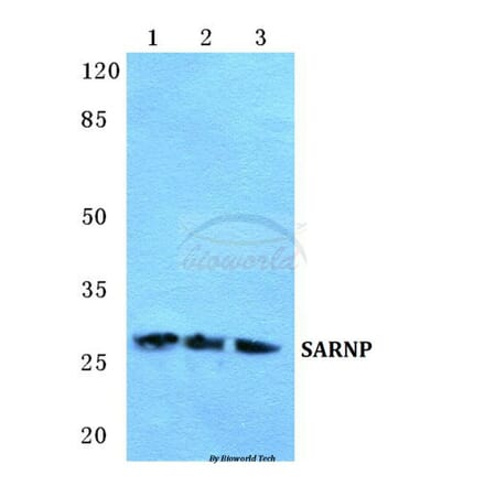 Anti-SARNP Antibody from Bioworld Technology (BS5663) - Antibodies.com