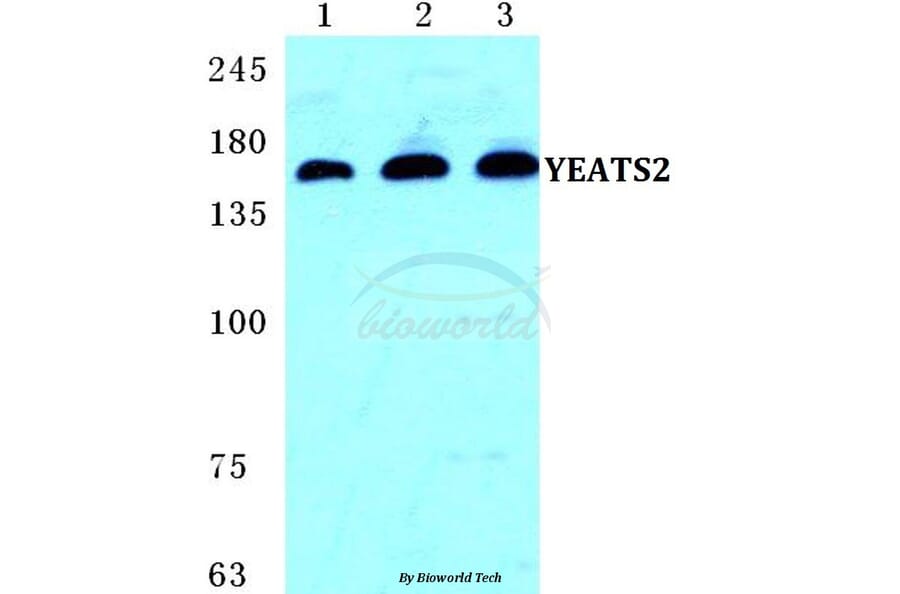 Anti-YEATS2 Antibody from Bioworld Technology (BS5668) - Antibodies.com