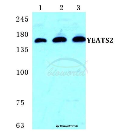 Anti-YEATS2 Antibody from Bioworld Technology (BS5668) - Antibodies.com