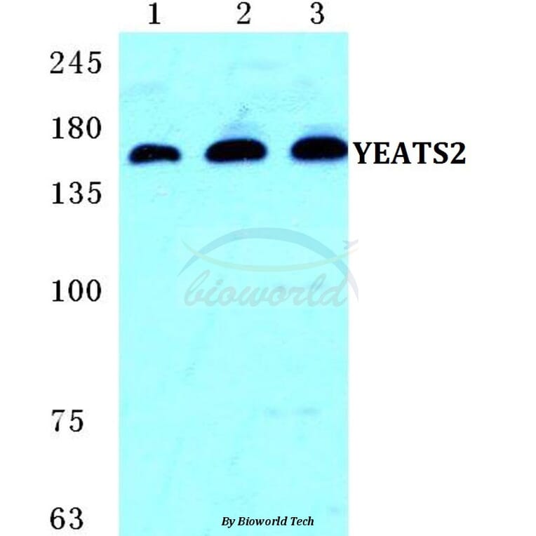 Anti-YEATS2 Antibody from Bioworld Technology (BS5668) - Antibodies.com