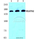 Anti-YEATS2 Antibody from Bioworld Technology (BS5668) - Antibodies.com