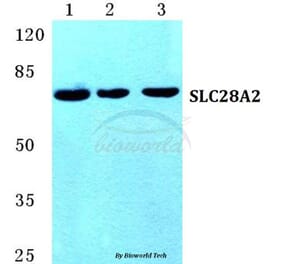 Anti-SLC28A2 Antibody from Bioworld Technology (BS5670) - Antibodies.com