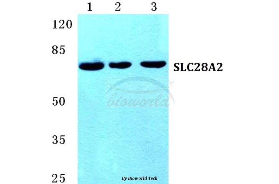 Anti-SLC28A2 Antibody from Bioworld Technology (BS5670) - Antibodies.com
