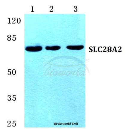 Anti-SLC28A2 Antibody from Bioworld Technology (BS5670) - Antibodies.com