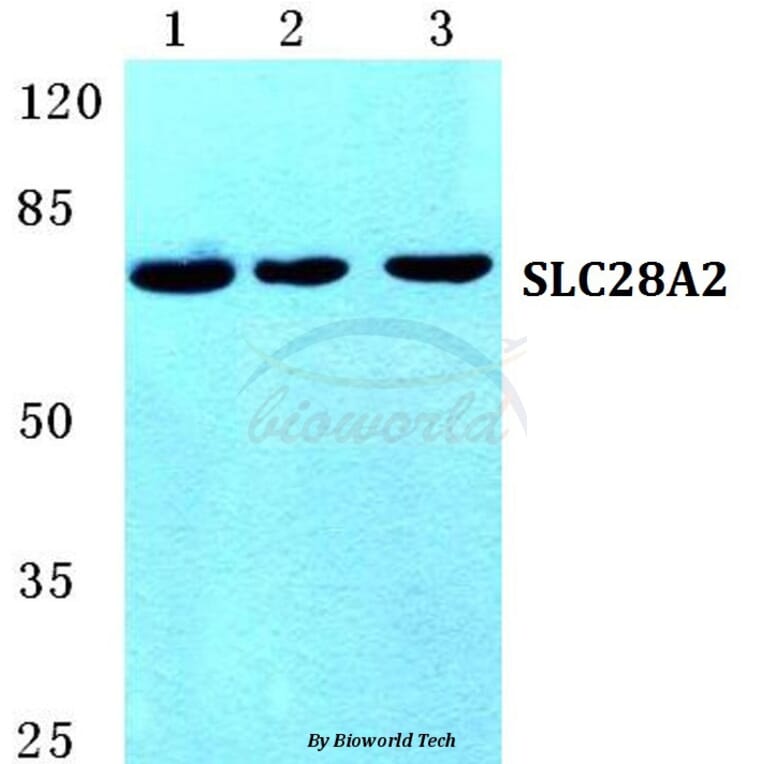 Anti-SLC28A2 Antibody from Bioworld Technology (BS5670) - Antibodies.com