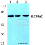 Anti-SLC28A2 Antibody from Bioworld Technology (BS5670) - Antibodies.com