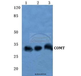 Anti-COMT Antibody from Bioworld Technology (BS5671) - Antibodies.com