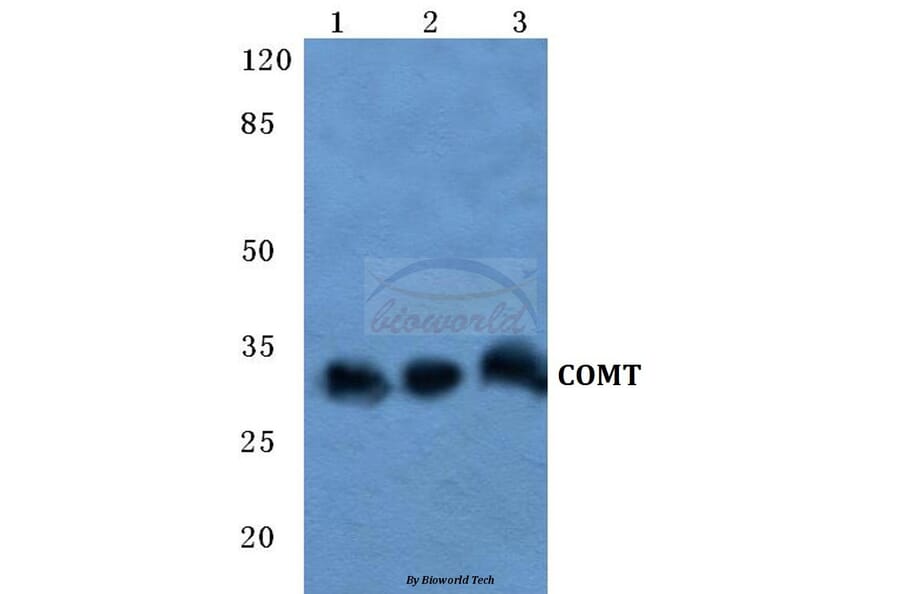 Anti-COMT Antibody from Bioworld Technology (BS5671) - Antibodies.com