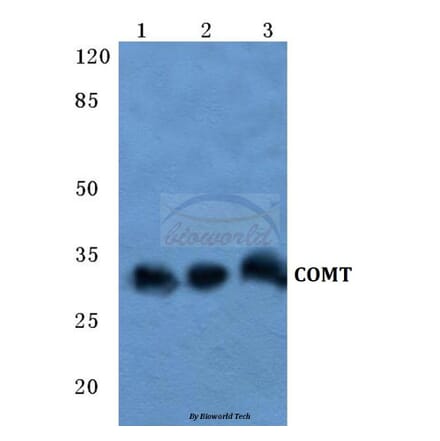 Anti-COMT Antibody from Bioworld Technology (BS5671) - Antibodies.com