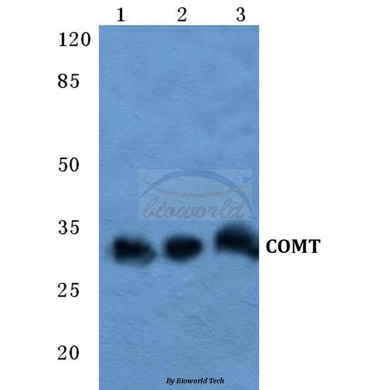 Anti-COMT Antibody from Bioworld Technology (BS5671) - Antibodies.com
