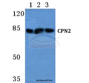 Anti-CPN2 Antibody from Bioworld Technology (BS5676) - Antibodies.com