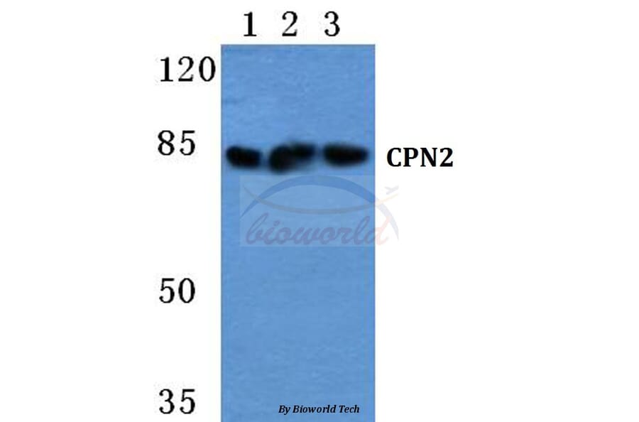 Anti-CPN2 Antibody from Bioworld Technology (BS5676) - Antibodies.com