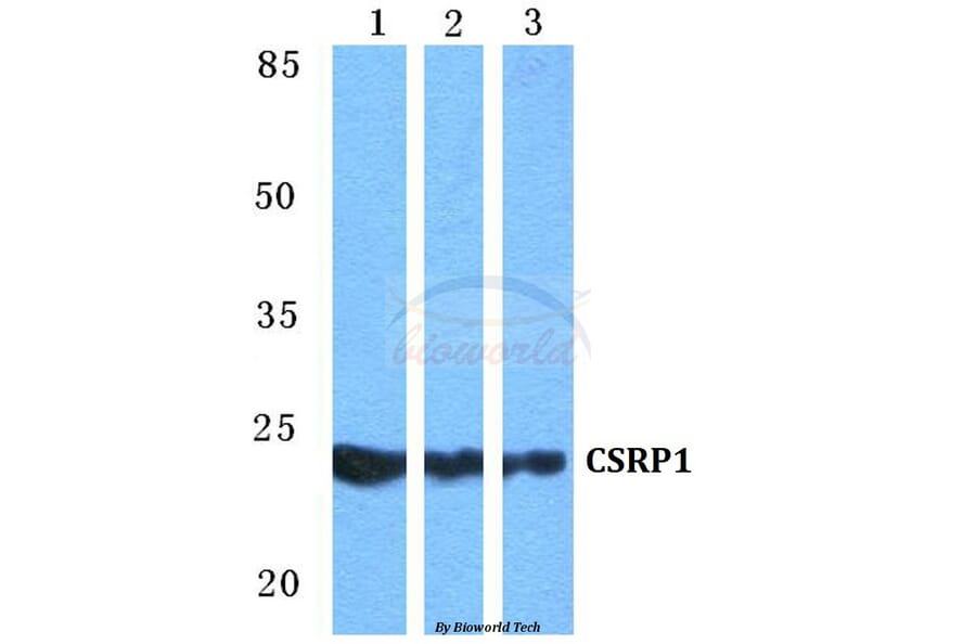 Anti-CSRP1 Antibody from Bioworld Technology (BS5677) - Antibodies.com