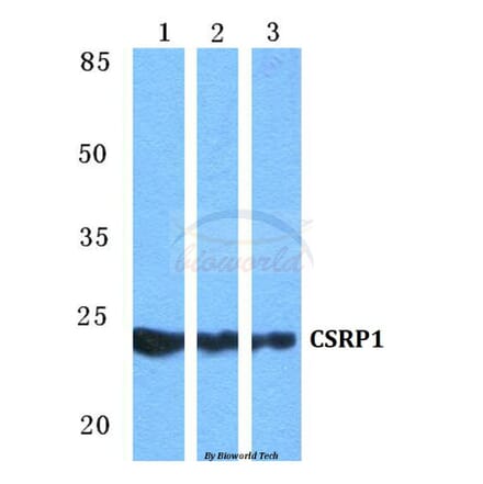 Anti-CSRP1 Antibody from Bioworld Technology (BS5677) - Antibodies.com