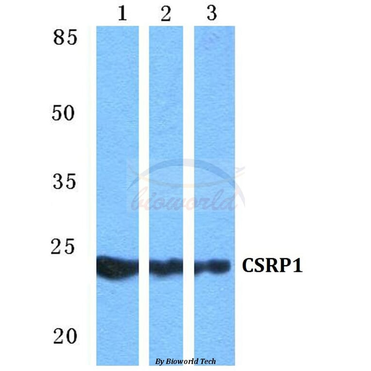 Anti-CSRP1 Antibody from Bioworld Technology (BS5677) - Antibodies.com