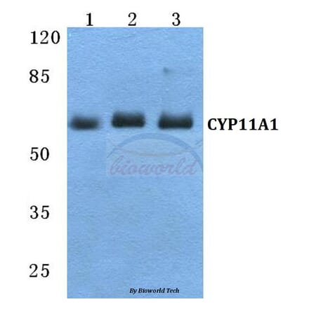 Anti-CYP11A1 Antibody from Bioworld Technology (BS5680) - Antibodies.com
