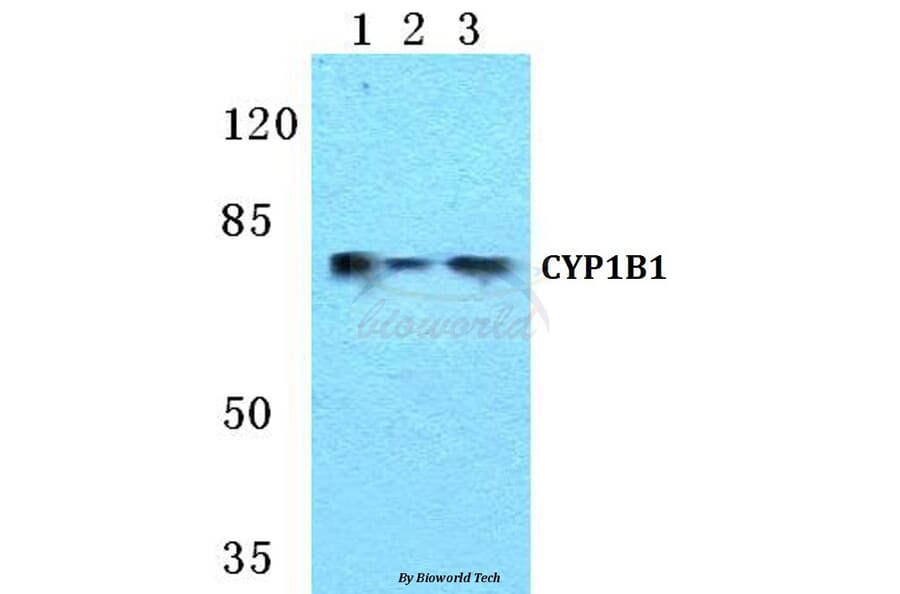 Anti-CYP1B1 Antibody from Bioworld Technology (BS5681) - Antibodies.com