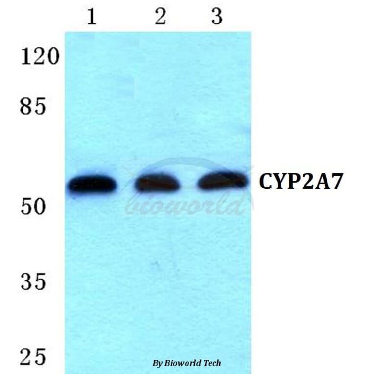 Anti-CYP2A7 Antibody from Bioworld Technology (BS5683) - Antibodies.com