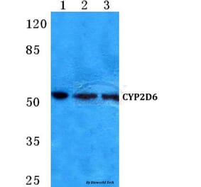 Anti-CYP2D6 (A300) Antibody from Bioworld Technology (BS5684) - Antibodies.com