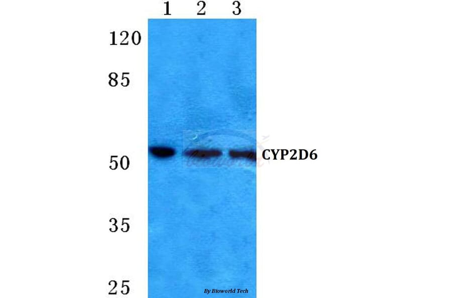 Anti-CYP2D6 (A300) Antibody from Bioworld Technology (BS5684) - Antibodies.com