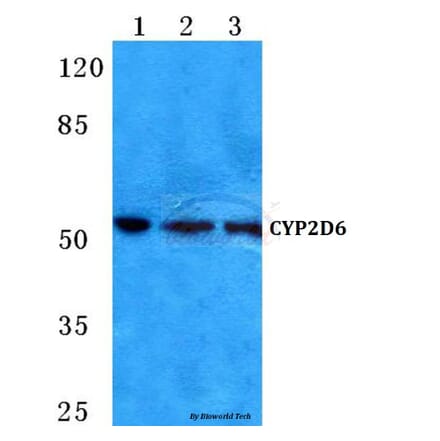 Anti-CYP2D6 (A300) Antibody from Bioworld Technology (BS5684) - Antibodies.com