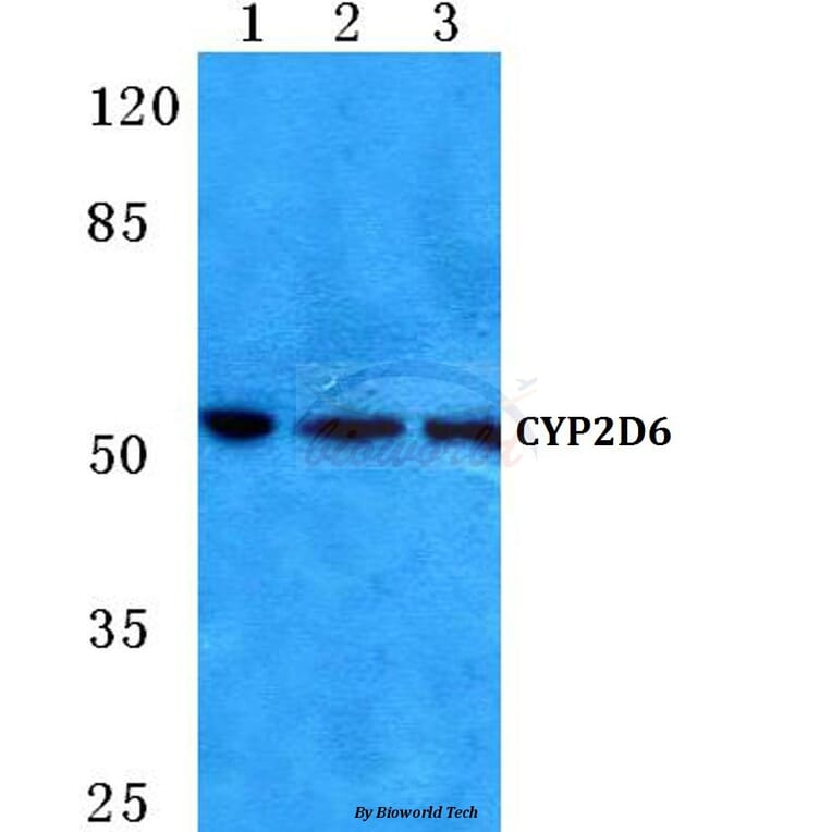 Anti-CYP2D6 (A300) Antibody from Bioworld Technology (BS5684) - Antibodies.com