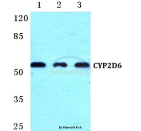 Anti-CYP2D6 (R450) Antibody from Bioworld Technology (BS5685) - Antibodies.com