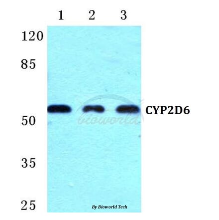 Anti-CYP2D6 (R450) Antibody from Bioworld Technology (BS5685) - Antibodies.com