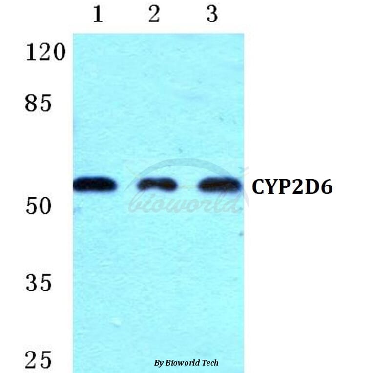 Anti-CYP2D6 (R450) Antibody from Bioworld Technology (BS5685) - Antibodies.com