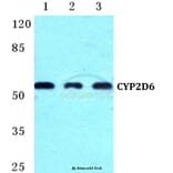 Anti-CYP2D6 (R450) Antibody from Bioworld Technology (BS5685) - Antibodies.com