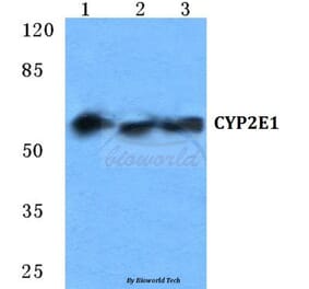 Anti-CYP2E1 Antibody from Bioworld Technology (BS5686) - Antibodies.com