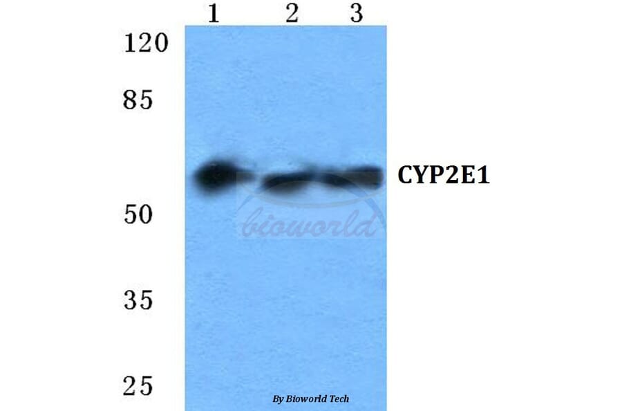 Anti-CYP2E1 Antibody from Bioworld Technology (BS5686) - Antibodies.com