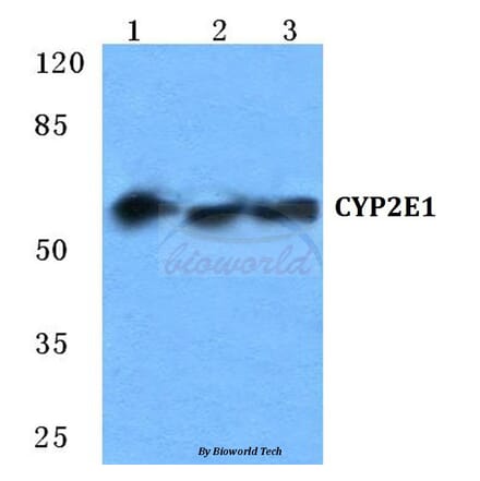 Anti-CYP2E1 Antibody from Bioworld Technology (BS5686) - Antibodies.com