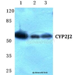 Anti-CYP2J2 Antibody from Bioworld Technology (BS5687) - Antibodies.com