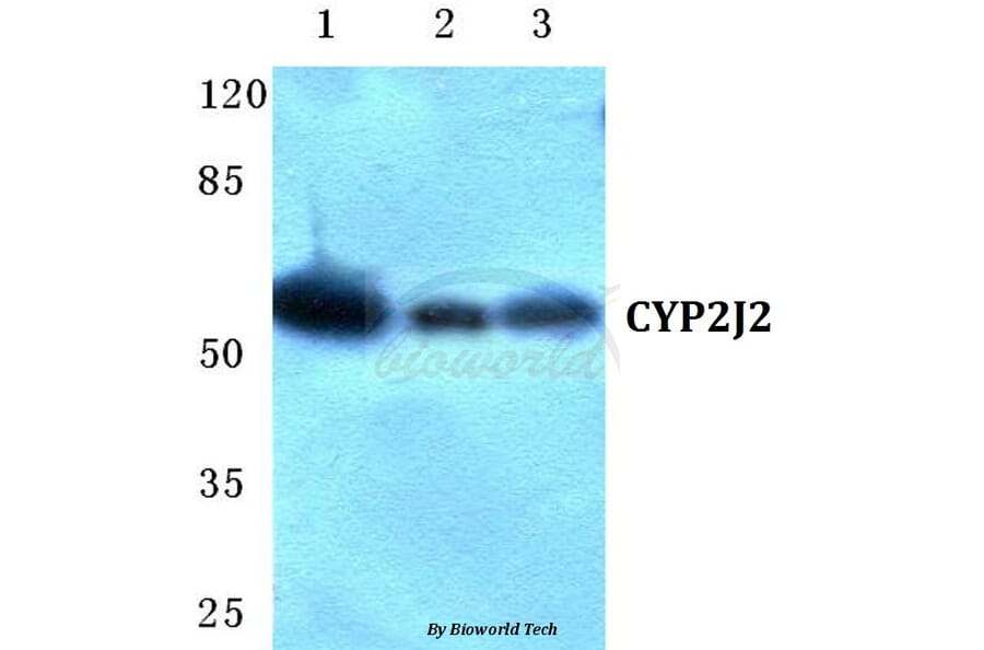 Anti-CYP2J2 Antibody from Bioworld Technology (BS5687) - Antibodies.com