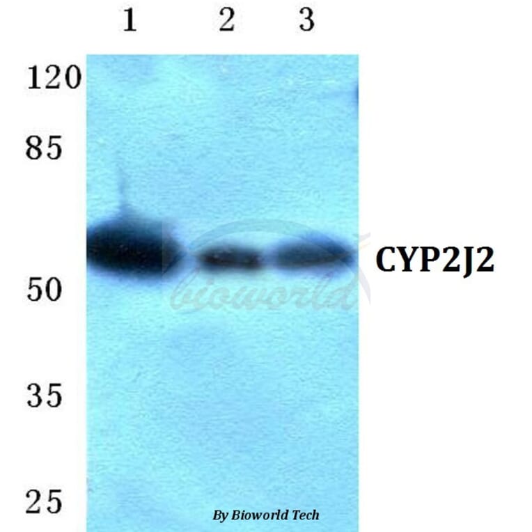 Anti-CYP2J2 Antibody from Bioworld Technology (BS5687) - Antibodies.com