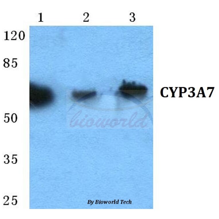 Anti-CYP3A7 Antibody from Bioworld Technology (BS5689) - Antibodies.com