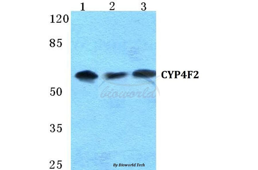 Anti-CYP4F2 Antibody from Bioworld Technology (BS5690) - Antibodies.com