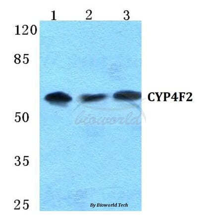 Anti-CYP4F2 Antibody from Bioworld Technology (BS5690) - Antibodies.com