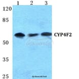 Anti-CYP4F2 Antibody from Bioworld Technology (BS5690) - Antibodies.com