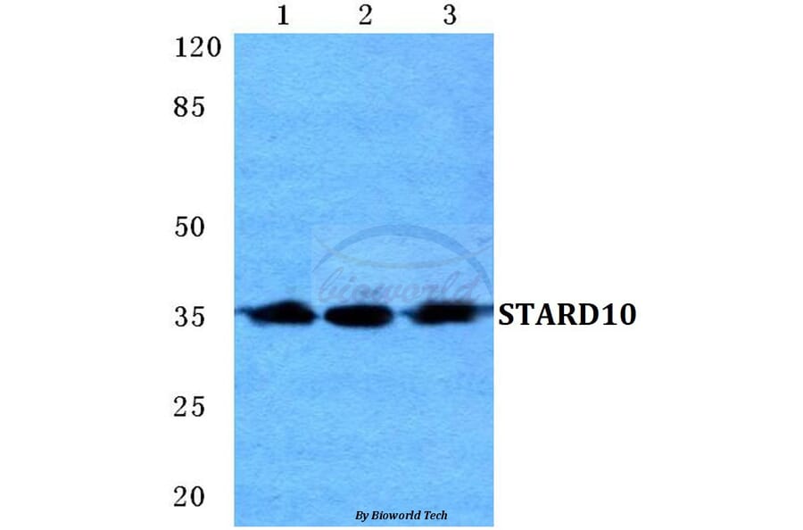 Anti-STARD10 Antibody from Bioworld Technology (BS5691) - Antibodies.com