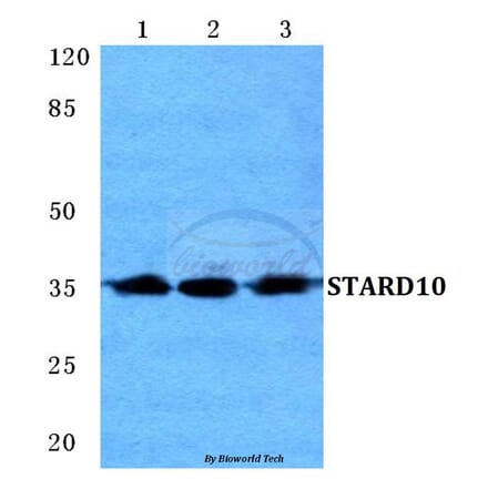 Anti-STARD10 Antibody from Bioworld Technology (BS5691) - Antibodies.com