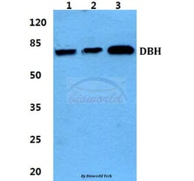 Anti-DBH Antibody from Bioworld Technology (BS5695) - Antibodies.com