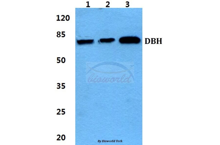 Anti-DBH Antibody from Bioworld Technology (BS5695) - Antibodies.com