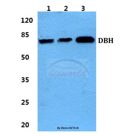Anti-DBH Antibody from Bioworld Technology (BS5695) - Antibodies.com