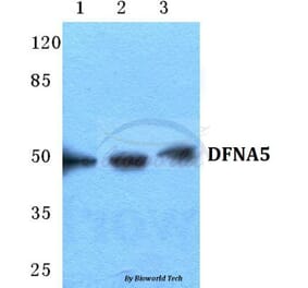 Anti-DFNA5 Antibody from Bioworld Technology (BS5697) - Antibodies.com